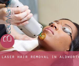 Laser Hair removal in Aldworth
