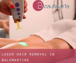 Laser Hair removal in Balemartine