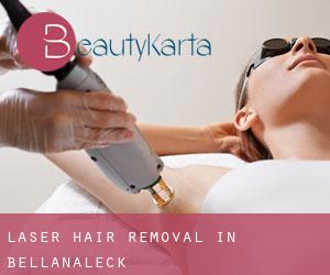 Laser Hair removal in Bellanaleck