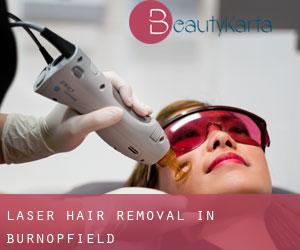 Laser Hair removal in Burnopfield