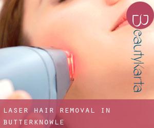Laser Hair removal in Butterknowle