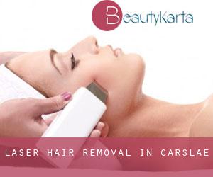Laser Hair removal in Carslae