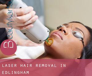 Laser Hair removal in Edlingham