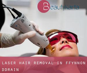 Laser Hair removal in Ffynnon-ddrain