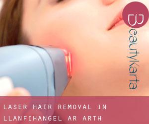 Laser Hair removal in Llanfihangel-ar-Arth