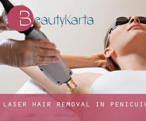 Laser Hair removal in Penicuik