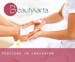 Pedicure in Craigavon