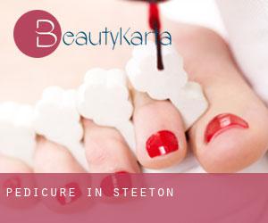 Pedicure in Steeton